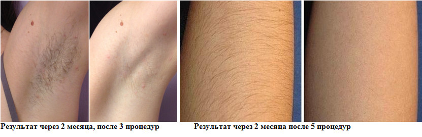 Что еще нужно знать о Diolaze